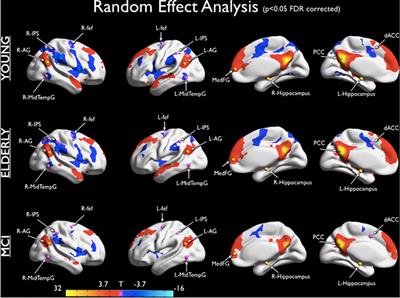 Brain Entropy During Aging Through a Free Energy Principle Approach